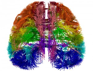 brain map